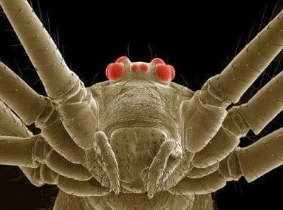 تحت الميكروسكوب : شاهد عالم الحشرات كما لم تراه من قبل ! 26