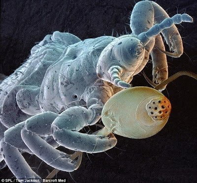 تحت الميكروسكوب : شاهد عالم الحشرات كما لم تراه من قبل ! 14