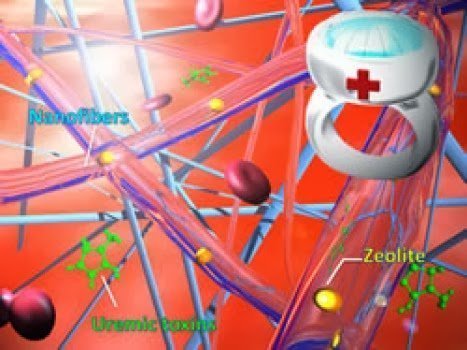 شبكة ألياف النانو الذكية تقنية جديدة لعلاج الفشل الكلوي
