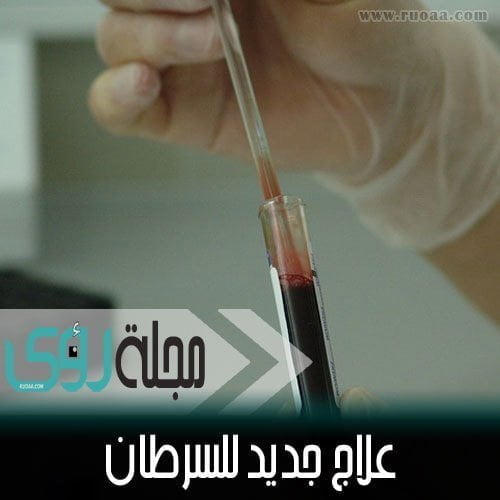 العلماء يعثرون على مفتاح يحول الخلايا السرطانية لخلايا عادية ! 25