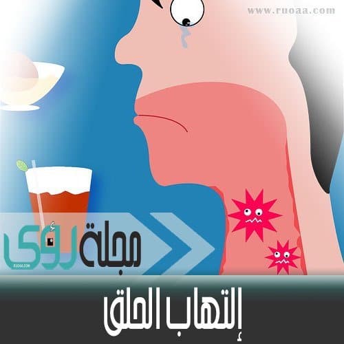 أسباب التهاب الحلق 