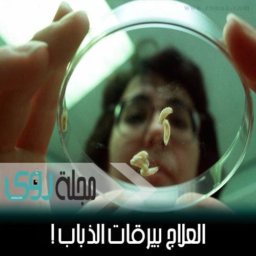 تعرف على فوائد علاج الجروح بإستخدام يرقات الذباب ! 14