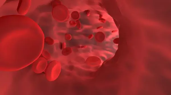 هل يستهدف فيروس كوفيد-19 الأوعية الدموية ذاتها ؟