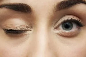Eye-twitching-causes-and-how-to-treat