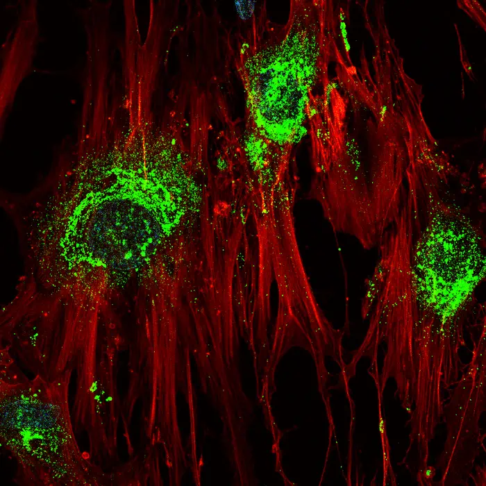 صورة مكبرة تظهر الخلايا الجذعية البالغة وهي في طور التحول إلى خلايا عظمية