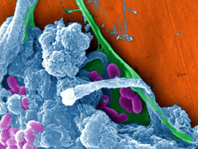 What is biofilm and why do we hate sticky things? 2 biofilm