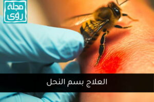 العلاج بلسع النحل -سم النحل