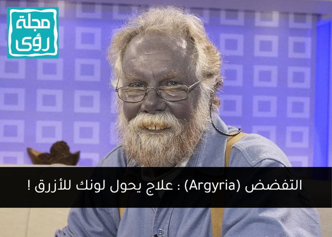 التفضض (Argyria)