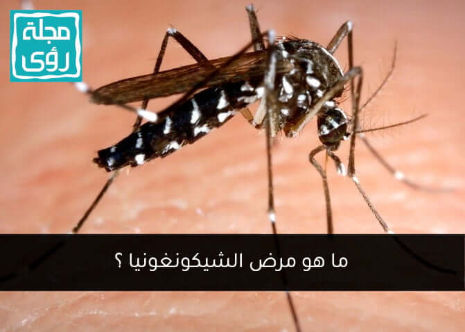 ما هو مرض الشيكونغونيا Chikungunya ؟