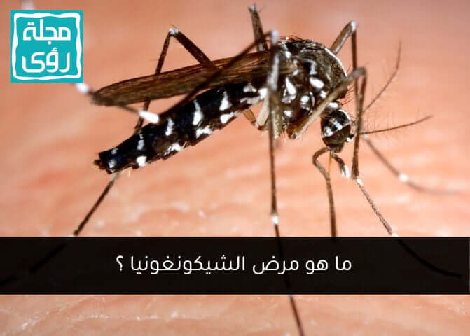 ما هو مرض الشيكونغونيا Chikungunya ؟ 8